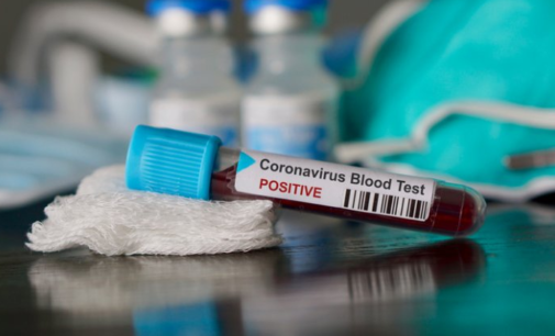 Coronavirus hits Tunisia, Senegal, Morocco — making six cases in Africa