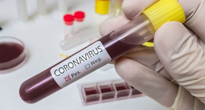 22 health workers test positive for COVID-19