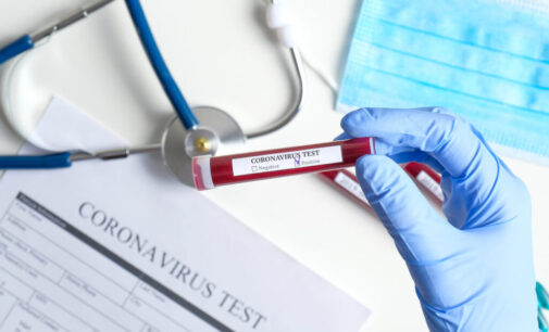 Six Togolese, Kano returnee test positive for COVID-19 in Oyo