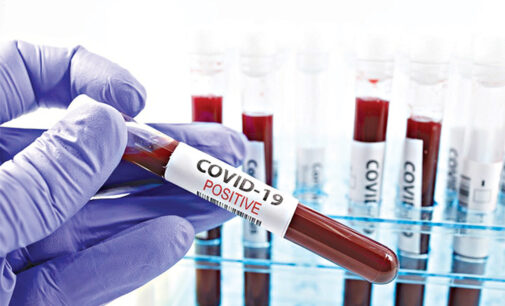 NCDC confirms 30 new coronavirus cases — 25 in Lagos