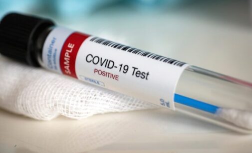 COVID-19: Nigeria records six new deaths, 1,588 positive infections in one day