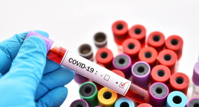 The COVID-19 pandemic is the defining health crisis of our time
