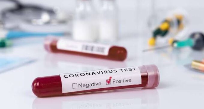 Kano records first case of coronavirus