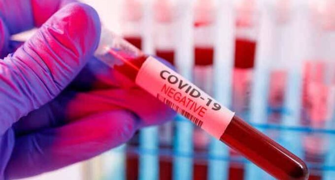 74 persons test negative for coronavirus in Ebonyi