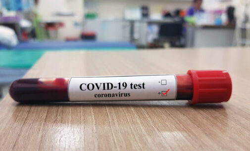 NCDC: 1,633 new samples test positive for COVID-19 — but over 1,000 recoveries in 24 hours