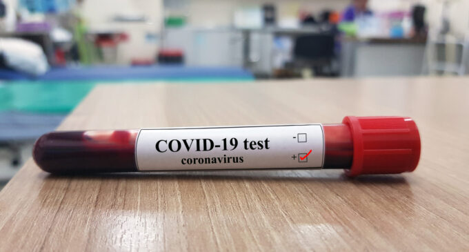 NCDC: 1,633 new samples test positive for COVID-19 — but over 1,000 recoveries in 24 hours