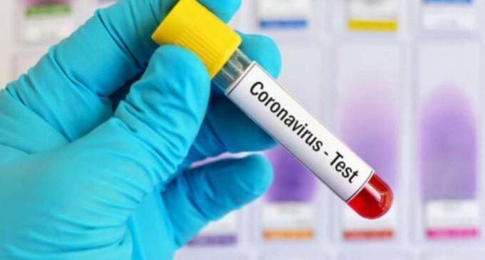 47 health workers test positive for COVID-19 in Kano