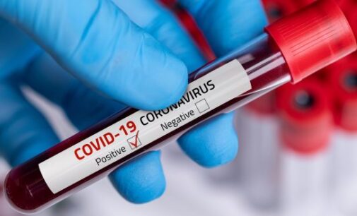 NCDC confirms 145 new COVID-19 cases