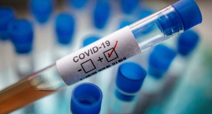 ‘From 665 to 6,677’ — how Nigeria recorded over 6,000 COVID-19 cases in one month