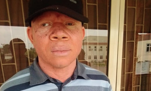 SPECIAL REPORT: How persons with albinism suffer in Lagos hospitals — despite special people’s law