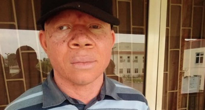 SPECIAL REPORT: How persons with albinism suffer in Lagos hospitals — despite special people’s law