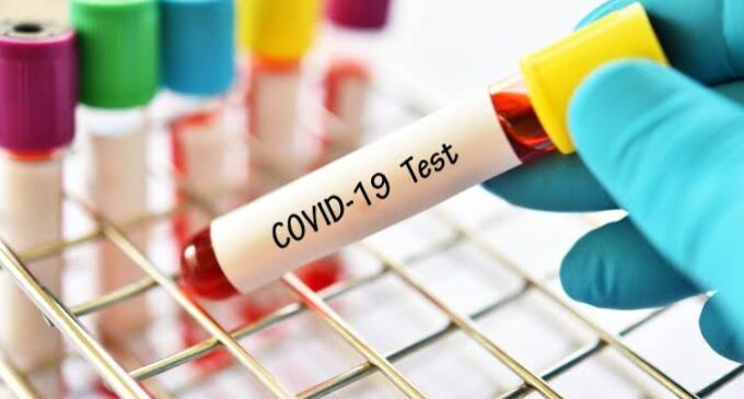 Ogun: COVID-19 test is free — but only for public schools