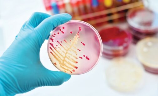 International Microorganism Day: When will Nigeria recognise the potential of microbiology?