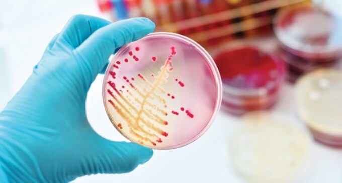 International Microorganism Day: When will Nigeria recognise the potential of microbiology?