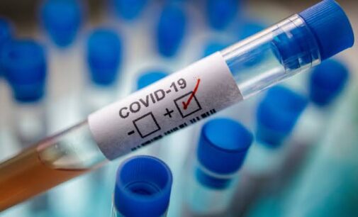 COVID-19 cases reach 30m globally — but 22m have recovered