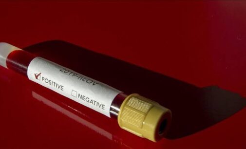 NCDC confirms 198 new coronavirus infections