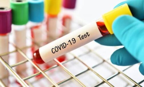 COVID-19: Nigeria logs 1,064 fresh infections — but 196 recoveries
