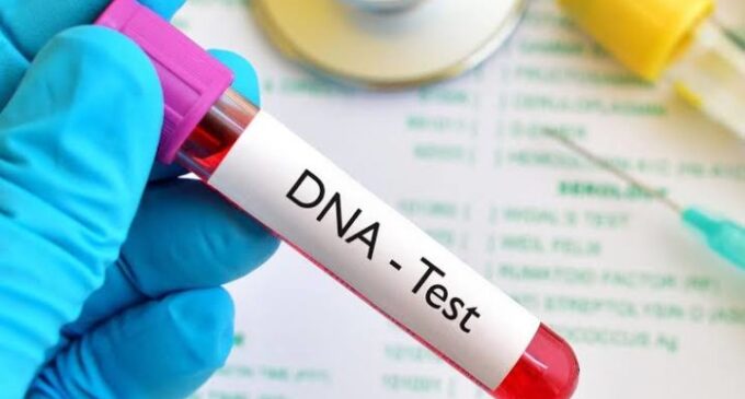 DNA test — the new pandemic