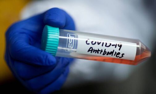 Faster recovery, non-severe diseases — new coronavirus antibody could be game changer