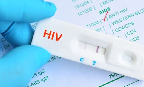 UNAIDS: New HIV variant not a major public health threat