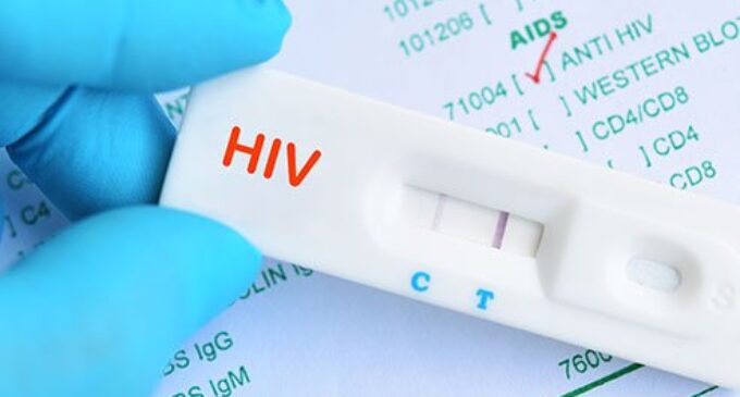 UNAIDS: New HIV variant not a major public health threat