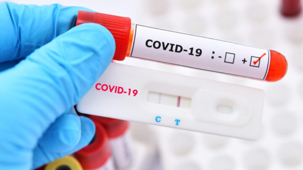 Nigeria, Egypt, South Africa... Canada no longer accepting COVID test  results from 10 African countries | TheCable