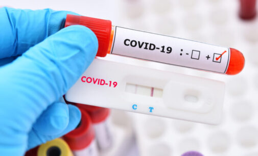 Study: COVID antibodies last up to 10 months after infection