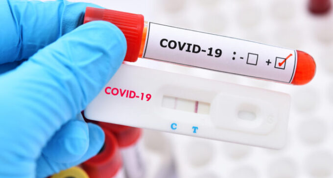FG: COVID tests no longer required for travellers irrespective of vaccination status