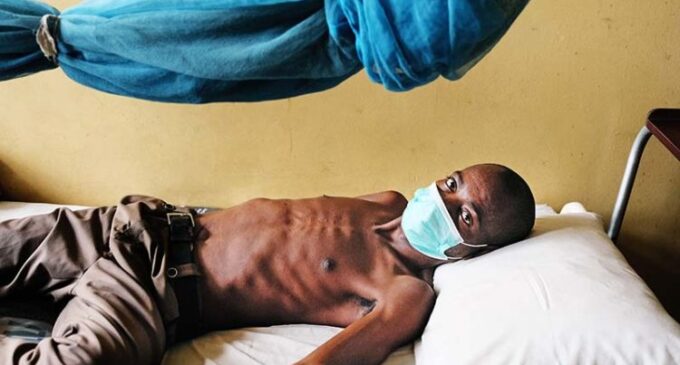 Anambra: One in 13 residents infected with tuberculosis
