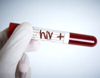 Scientists discover new ‘highly transmissible’ HIV variant in Netherlands