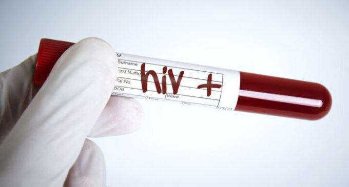UNICEF: 22,000 Nigerian children infected with HIV annually