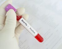 ALERT: China records ‘first human case’ of H10N3 bird flu