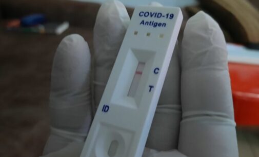 EXPLAINER: What is COVID lateral flow, UK’s replacement for PCR arrival test?