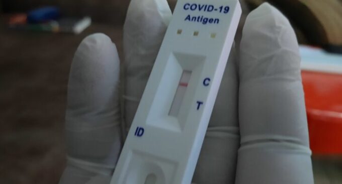 EXPLAINER: What is COVID lateral flow, UK’s replacement for PCR arrival test?
