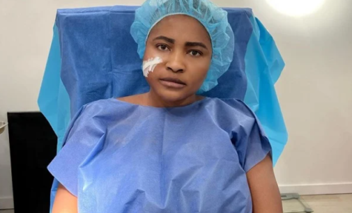 ‘I felt like ending it all’ — Sonia Ogiri opens up on facial scar, undergoes treatment
