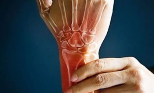 Medical experts raise concern on prevalence of rheumatoid arthritis
