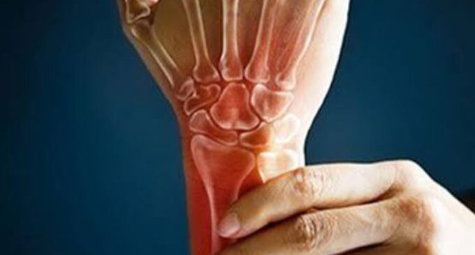 Medical experts raise concern on prevalence of rheumatoid arthritis
