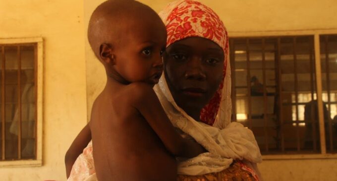 Nigeria’s future at the mercy of child malnutrition
