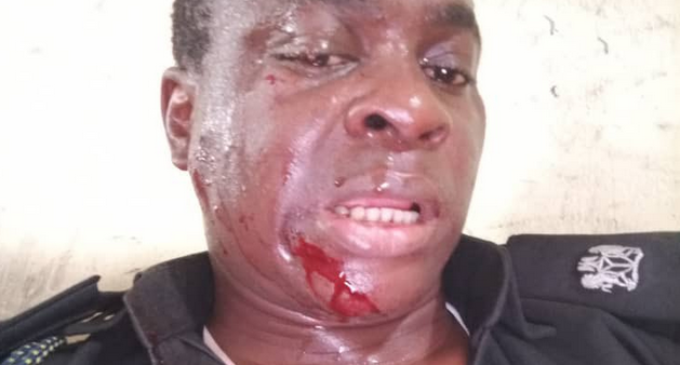 Police: Two officers shot by Yoruba nation agitators in Lagos