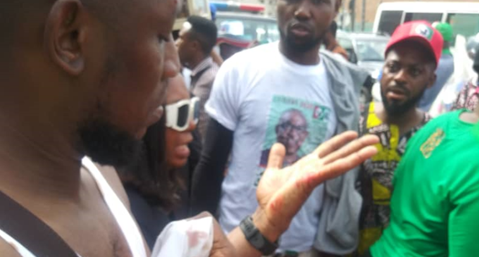 Hoodlums attack LP supporters as Obi campaigns in Lagos