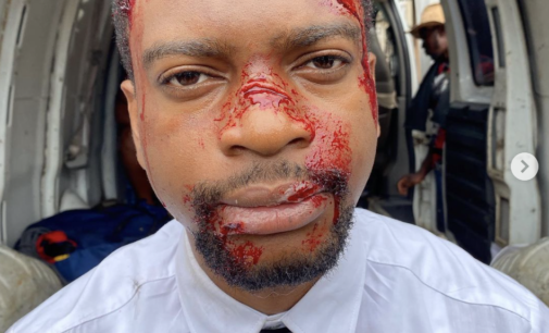 FACT CHECK: Bloodied picture of Olumide Oworu, LP Lagos assembly candidate, is from movie set