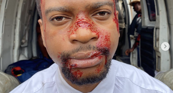 FACT CHECK: Bloodied picture of Olumide Oworu, LP Lagos assembly candidate, is from movie set